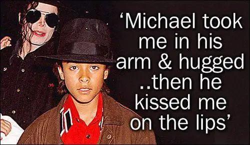 迈克尔杰克逊的皮肤为什么变白了(迈克尔杰克逊的脸怎么变白的)