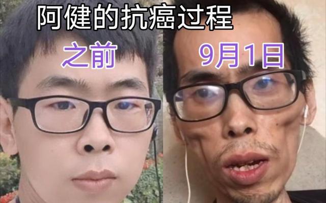 抗癌小伙阿健葬礼(抗癌小伙阿健去世1)