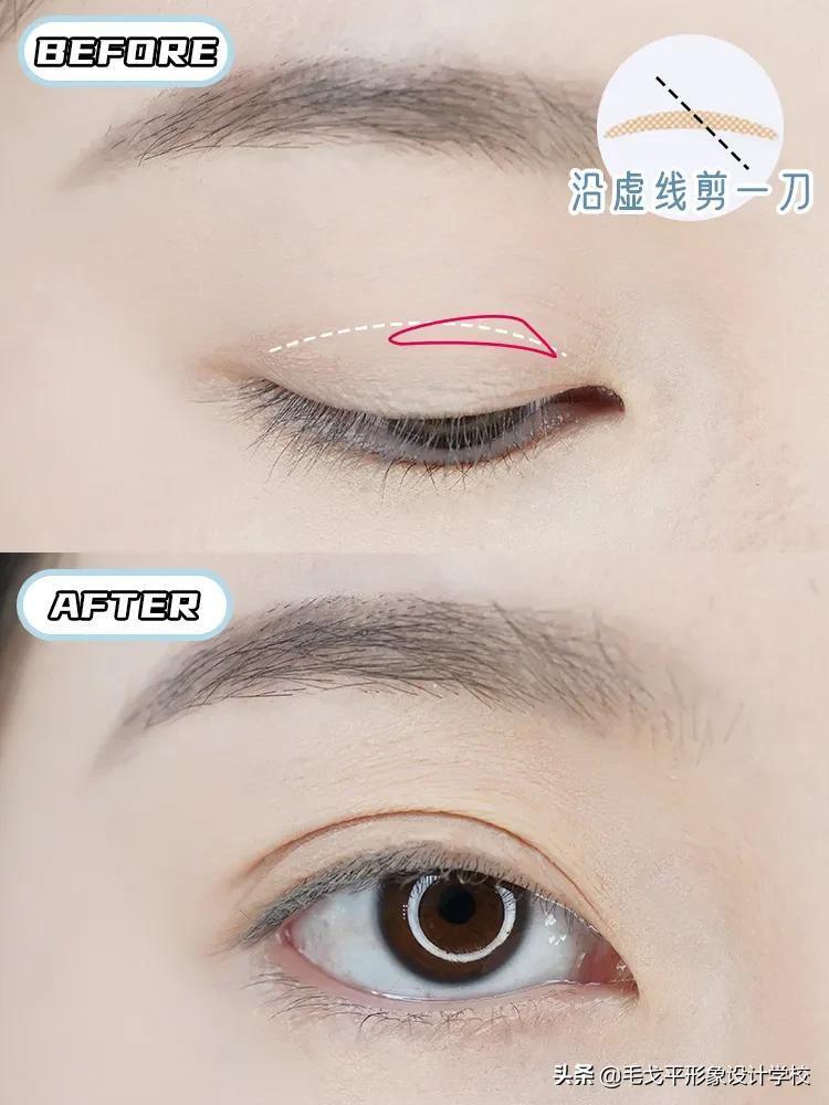 如何贴双眼皮_双眼皮的正确贴法步骤
