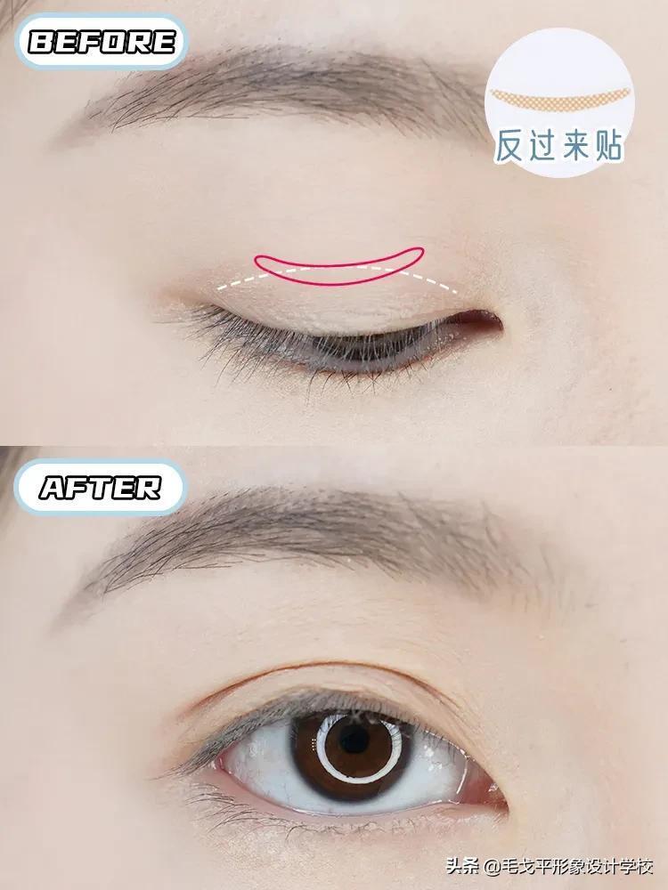如何贴双眼皮_双眼皮的正确贴法步骤
