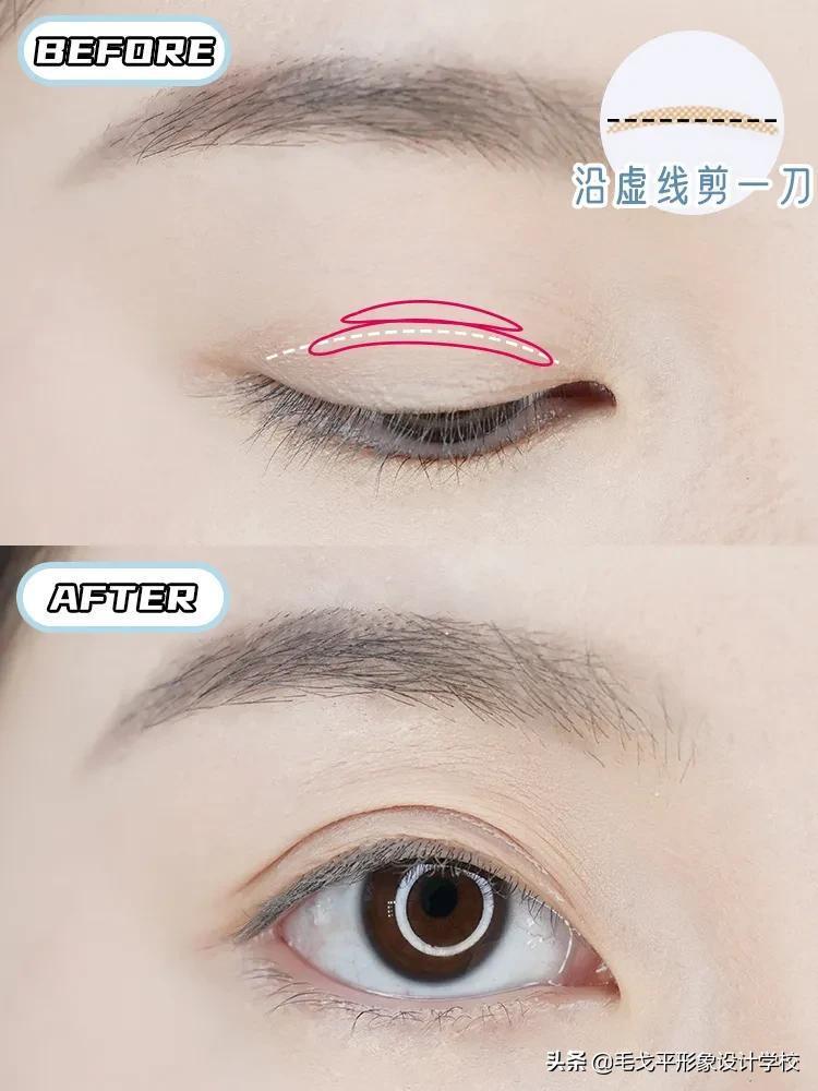 如何贴双眼皮_双眼皮的正确贴法步骤