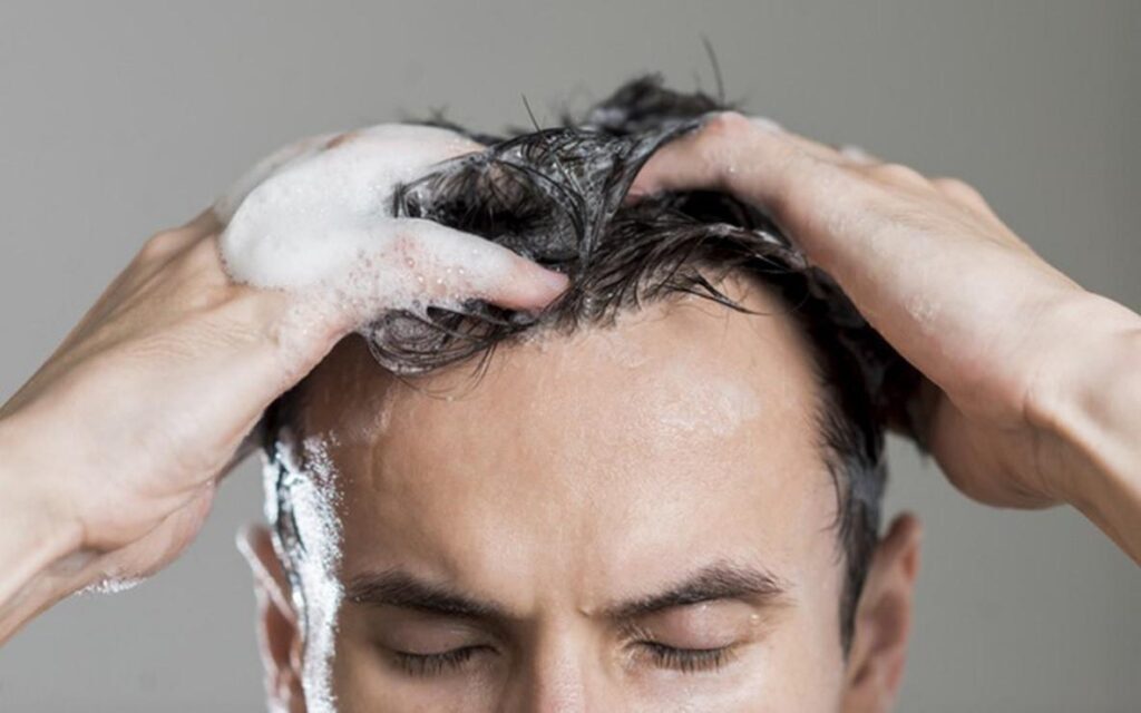 头发为什么容易油腻_头发油腻的改善方法