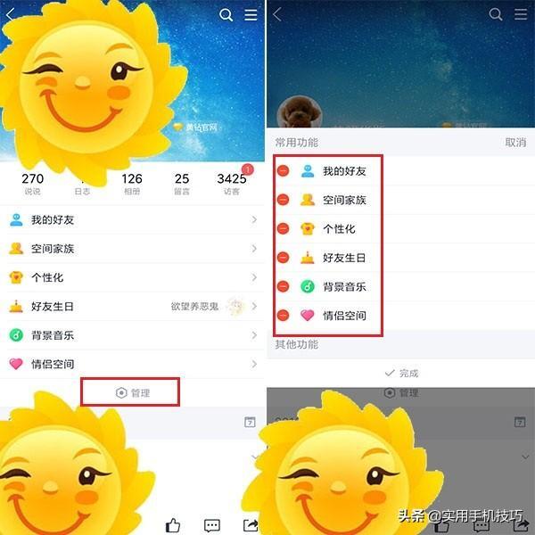 黄钻怎么关闭_黄钻的关闭方法