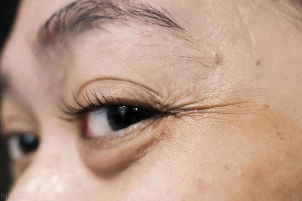 眼部皮肤衰老有什么特征_眼部皮肤衰老的特征和保养