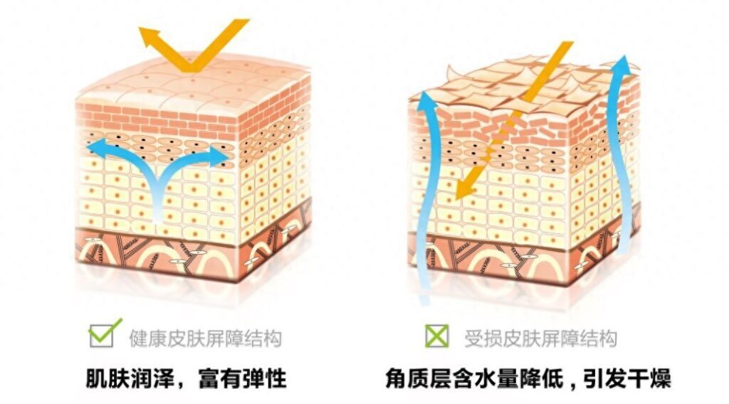 最有效祛斑方法是什么，色斑是什么原因造成的