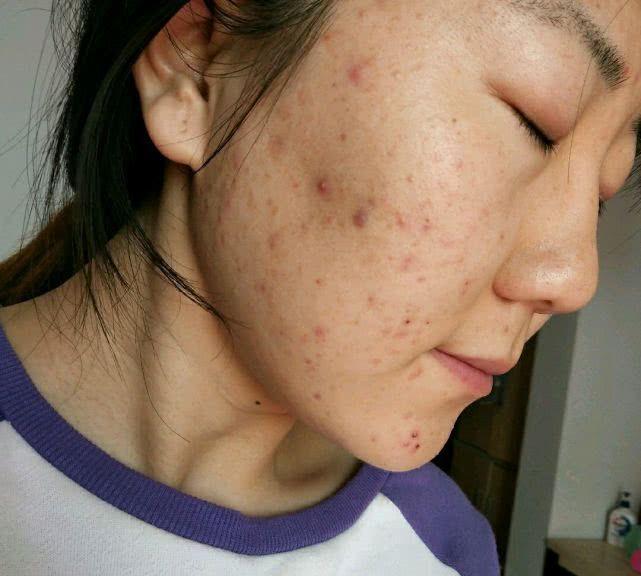 女孩越长越丑怎么办？女孩越长越丑的征兆有哪些？