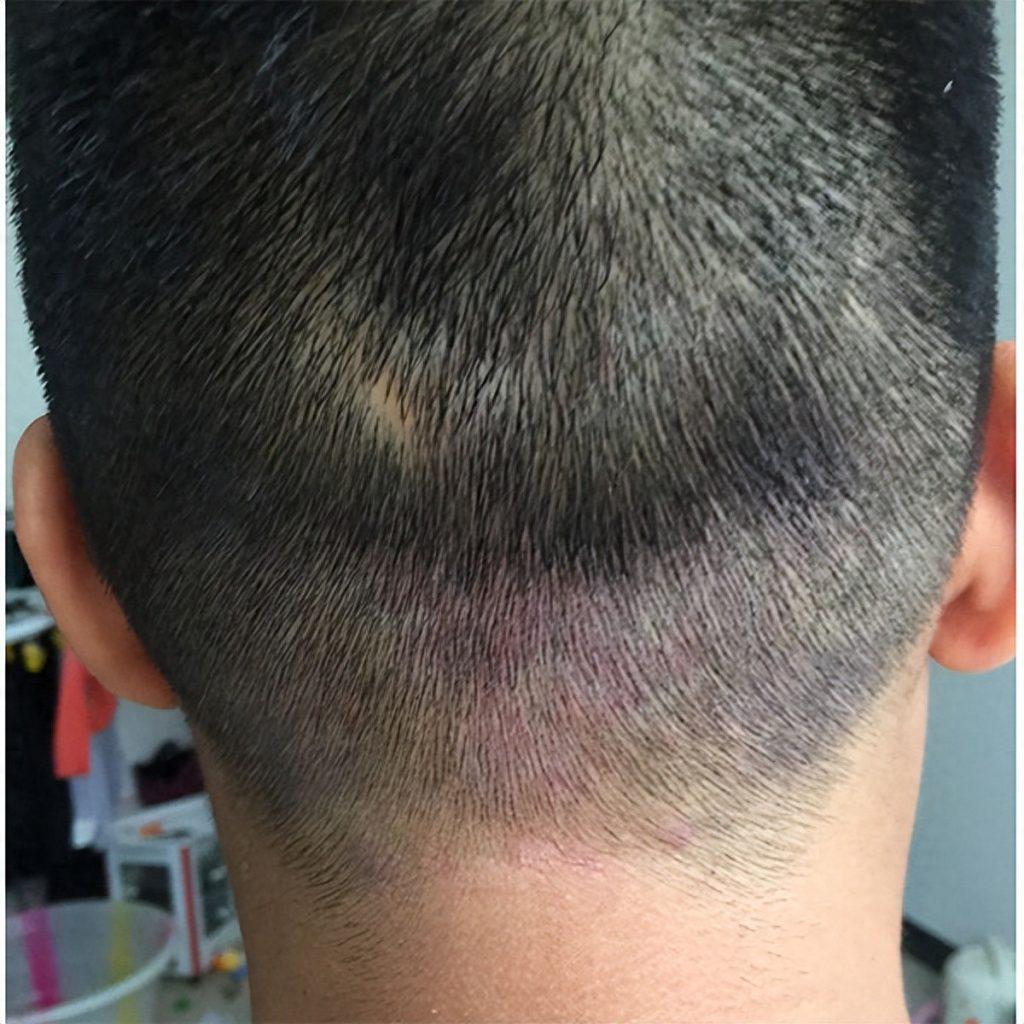 男士洗发水推荐哪一款？男士洗发水品牌推荐